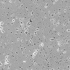 竞争产品 2：显露不良致密度的样品